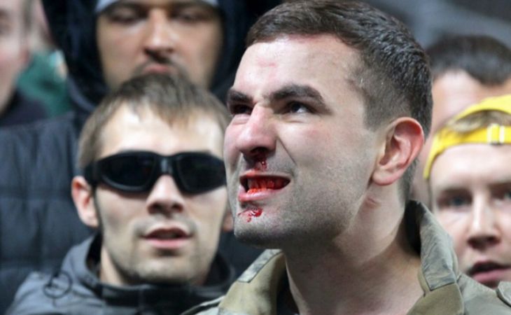 Футбольному фанату разбили нос на матче Швеция-Россия
