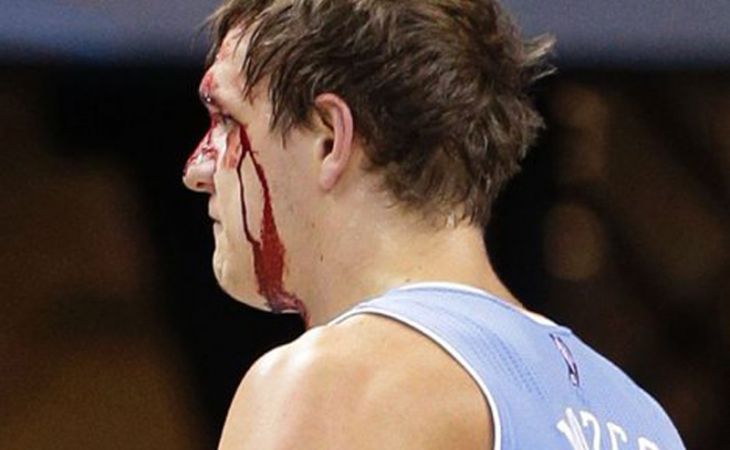 Россиянин Тимофей Мозгов получил травму лица в матче НБА