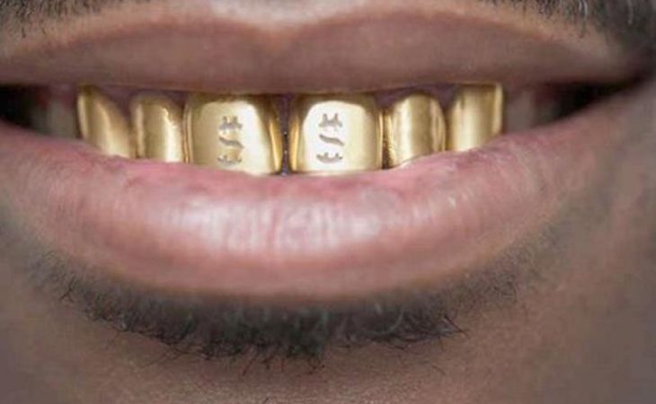 Мужчина на Алтае похитил у своей подруги зубной протез из золота 985 пробы