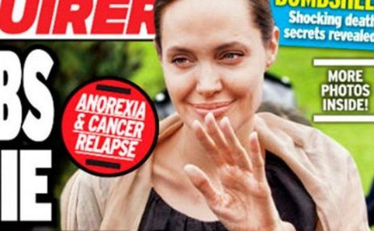 Джоли умирает: актриса похудела до 37 кг из-за тяжелой болезни