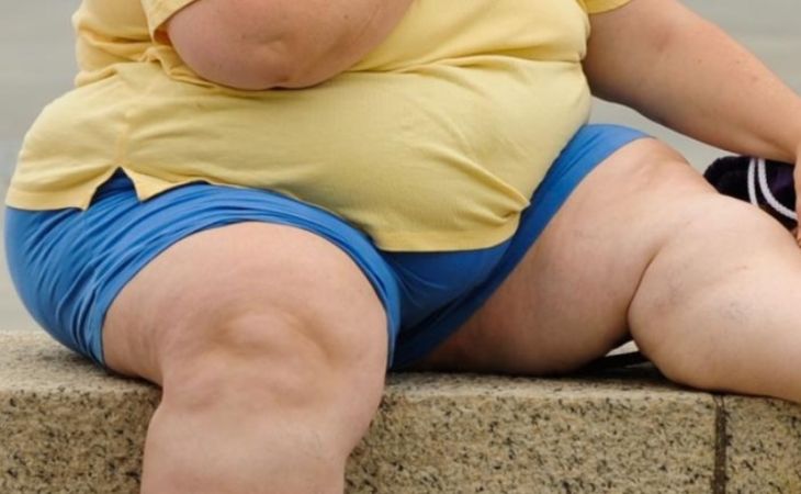 Госдума предлагает людям с ожирением давать бесплатный абонемент в спортзал
