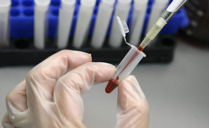 Минздрав предложил принудительно тестировать на ВИЧ наркоманов и заключённых