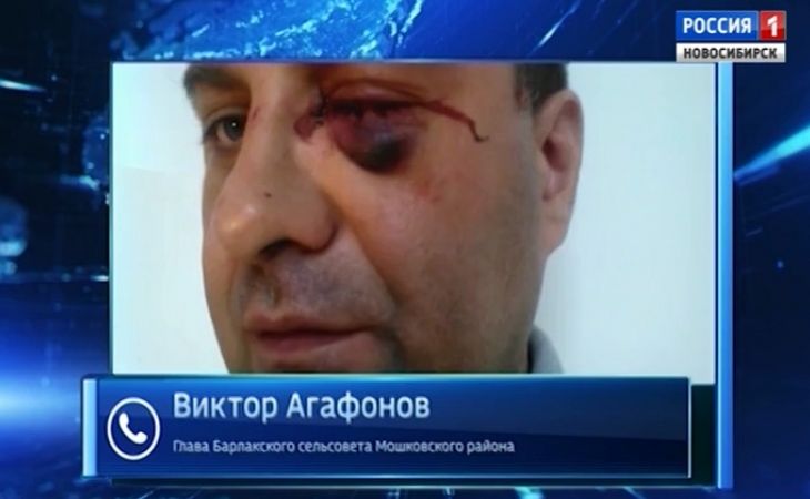 Легкий вред здоровью: новосибирского депутата от "ЕР" осудили за избиение главы сельсовета