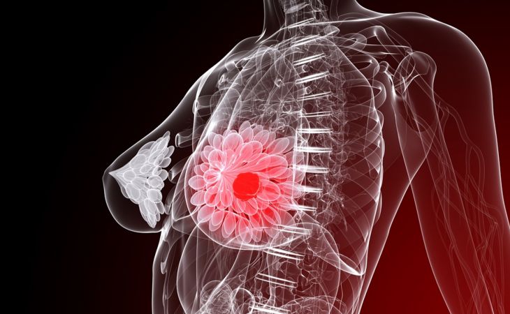 Рак груди связали с накоплением в организме пестицида ДДТ
