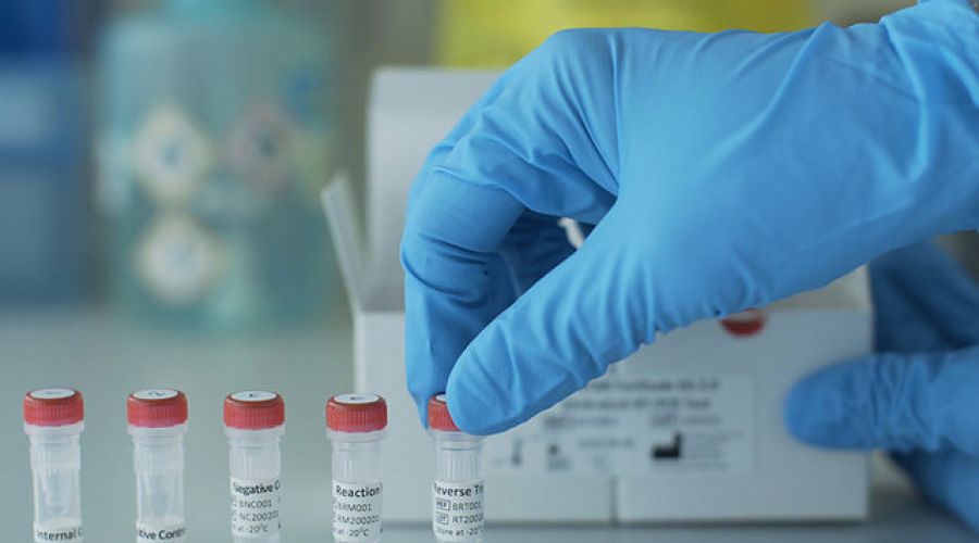 Где в Барнауле можно сдать анализ на антитела к коронавирусу